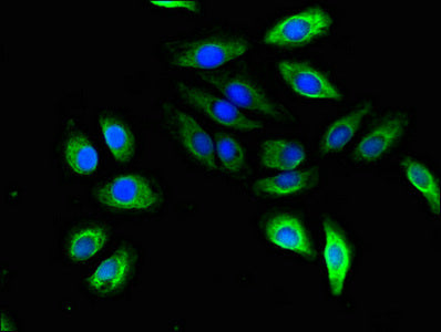 Immunofluorescent analysis of A549 cells using STMN2 Antibody at dilution of 1:100 and Alexa Fluor 488-congugated AffiniPure Goat Anti-Rabbit IgG(H+L)Rabbit anti-Human STMN2 Polyclonal Antibody