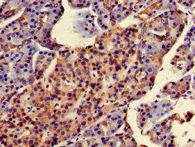 Immunohistochemistry of paraffin-embedded human pancreatic tissue using the antibody at dilution of 1:100Rabbit anti-Human STMN2 Polyclonal Antibody
