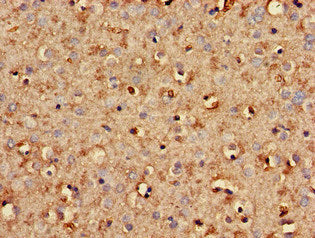 Immunohistochemistry of paraffin-embedded human brain tissue using STMN2 Antibody at dilution of 1:100Rabbit anti-Human STMN2 Polyclonal Antibody