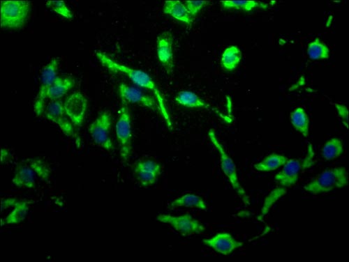 Immunofluorescence staining of HepG2 cells with MR1 Antibody at 1:200, counter-stained with DAPI.The cells were fixed in 4% formaldehyde, permeated by 0.2% TritonX-100, and blocked in 10% normal Goat Serum. The cells were then incubated with the antibody overnight at 4°C. Nuclear DNA was labeled in blue with DAPI. The secondary antibody was Alexa Fluor 488-congugated AffiniPure Goat Anti-Rabbit IgG(H+L)Rabbit anti-Human MR1 Polyclonal Antibody