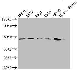 Western Blot | Positive WB detected in: THP-1 whole cell lysate, K-562 whole cell lysate, Raji whole cell lysate, Hela whole cell lysate, A2780 whole cell lysate, Mouse Brain tissue | All lanes: MR1 antibody at 1:2000 | Secondary | Goat polyclonal to rabbit IgG at 1/50000 dilution | Predicted band size: 40, 35, 29, 26 kDa | Observed band size: 48 kDa