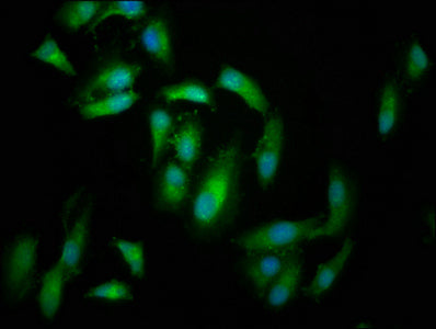 Immunofluorescence staining of Hela cells with FERMT2 Antibody at 1:166, counter-stained with DAPI. The cells were fixed in 4% formaldehyde, permeabilized using 0.2% Triton X-100 and blocked in 10% normal Goat Serum. The cells were then incubated with the antibody overnight at 4°C. The secondary antibody was Alexa Fluor 488-congugated AffiniPure Goat Anti-Rabbit IgG(H+L).Rabbit anti-Human FERMT2 Polyclonal Antibody
