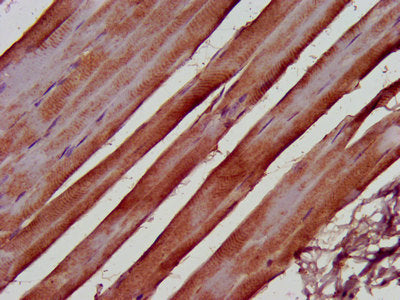 IHC image of the antibody diluted at 1:500 and staining in paraffin-embedded human skeletal muscle tissue performed on a Leica BondTM system. After dewaxing and hydration, antigen retrieval was mediated by high pressure in a citrate buffer (pH 6.0). Section was blocked with 10% normal goat serum 30min at RT. Then primary antibody (1% BSA) was incubated at 4°C overnight. The primary is detected by a biotinylated secondary antibody and visualized using an HRP conjugated SP system.Rabbit anti-Human FERMT2 Polyclonal Antibody