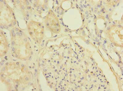 Immunohistochemistry of paraffin-embedded human kidney tissue using SLC25A36 Antibody at dilution of 1:100Rabbit anti-Human SLC25A36 Polyclonal Antibody