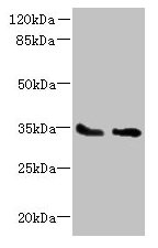 Western blot  | All lanes: SLC25A36 antibody at 4µg/ml  | Lane 1: A431 whole cell lysate  | Lane 2: A549 whole cell lysate  | Secondary  | Goat polyclonal to rabbit IgG at 1/10000 dilution  | Predicted band size: 35, 15, 18 kDa  | Observed band size: 35 kDaRabbit anti-Human SLC25A36 Polyclonal Antibody
