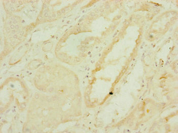 Immunohistochemistry of paraffin-embedded human kidney tissue using DNAJC19 Antibody at dilution of 1:100Rabbit anti-Human DNAJC19 Polyclonal Antibody