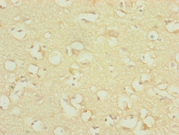 Immunohistochemistry of paraffin-embedded human brain tissue using DNAJC19 Antibody at dilution of 1:100Rabbit anti-Human DNAJC19 Polyclonal Antibody
