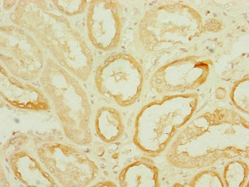 Immunohistochemistry of paraffin-embedded human kidney tissue using DNAJC19 Antibody at dilution of 1:100Rabbit anti-Human DNAJC19 Polyclonal Antibody