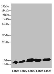 Western blot  | All lanes: DNAJC19 antibody at 0.9µg/ml  | Lane 1: Mouse lung tissue  | Lane 2: Mouse kidney tissue  | Lane 3: A549 whole cell lysate  | Lane 4: HL60 whole cell lysate  | Lane 5: Hela whole cell lysate  | Secondary  | Goat polyclonal to rabbit IgG at 1/10000 dilution  | Predicted band size: 13, 11 kDa  | Observed band size: 13 kDaRabbit anti-Human DNAJC19 Polyclonal Antibody