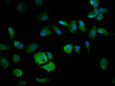 Immunofluorescence staining of MCF-7 cells with ELP4 Antibody at 1:200, counter-stained with DAPI. The cells were fixed in 4% formaldehyde, permeabilized using 0.2% Triton X-100 and blocked in 10% normal Goat Serum. The cells were then incubated with the antibody overnight at 4°C. The secondary antibody was Alexa Fluor 488-congugated AffiniPure Goat Anti-Rabbit IgG(H+L).Rabbit anti-Human ELP4 Polyclonal Antibody