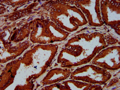 IHC image of the antibody diluted at 1:600 and staining in paraffin-embedded human prostate tissue performed on a Leica BondTM system. After dewaxing and hydration, antigen retrieval was mediated by high pressure in a citrate buffer (pH 6.0). Section was blocked with 10% normal goat serum 30min at RT. Then primary antibody (1% BSA) was incubated at 4°C overnight. The primary is detected by a biotinylated secondary antibody and visualized using an HRP conjugated SP system.Rabbit anti-Human ELP4 Polyclonal Antibody