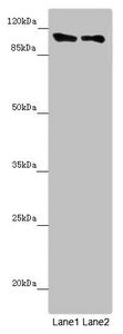 Western blot  | All lanes: DDX11 antibody at 8.47µg/ml  | Lane 1: Mouse gonadal tissue  | Lane 2: K562 whole cell lysate  | Secondary  | Goat polyclonal to rabbit IgG at 1/10000 dilution  | Predicted band size: 109, 102, 99, 97, 33 kDa  | Observed band size: 109 kDaRabbit anti-Human DDX11 Polyclonal Antibody