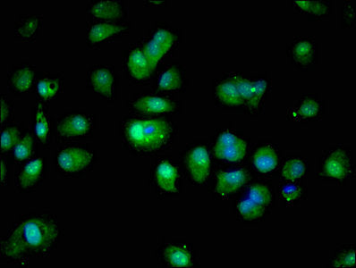 Immunofluorescent analysis of MCF-7 cells using S100A16 Antibody at dilution of 1:100 and Alexa Fluor 488-congugated AffiniPure Goat Anti-Rabbit IgG(H+L)Rabbit anti-Human S100A16 Polyclonal Antibody