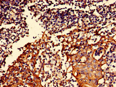 Immunohistochemistry of paraffin-embedded human tonsil tissue using the antibody at dilution of 1:100Rabbit anti-Human S100A16 Polyclonal Antibody