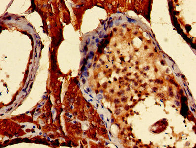 Immunohistochemistry of paraffin-embedded human testis tissue using S100A16 Antibody at dilution of 1:100Rabbit anti-Human S100A16 Polyclonal Antibody