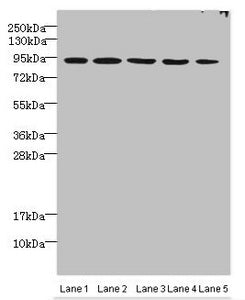 Western blot | All lanes: THOC1 antibody at 3μg/ml | Lane 1: Jurkats whole cell lysate | Lane 2: 293T whole cell lysate | Lane 3: HepG2 whole cell lysate | Lane 4: A549 whole cell lysate | Lane 5: Mouse kidney tissue | Secondary | Goat polyclonal to rabbit IgG at 1/10000 dilution | Predicted band size: 76, 44 kDa | Observed band size: 76 kDaRabbit anti-Human THOC1 Polyclonal Antibody