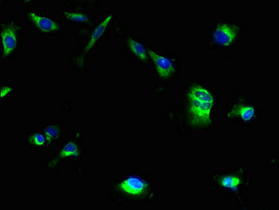 Immunofluorescent analysis of U251 cells using MRAP2 Antibody at dilution of 1:100 and Alexa Fluor 488-congugated AffiniPure Goat Anti-Rabbit IgG(H+L)