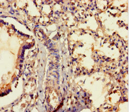 Immunohistochemistry of paraffin-embedded human lung tissue using MRAP2 Antibody at dilution of 1:100