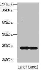 Western blot  | All lanes: MRAP2 antibody at 7µg/ml  | Lane 1: Mouse brain tissue  | Lane 2: Mouse kidney tissue  | Secondary  | Goat polyclonal to rabbit IgG at 1/10000 dilution  | Predicted band size: 24 kDa  | Observed band size: 24 kDa