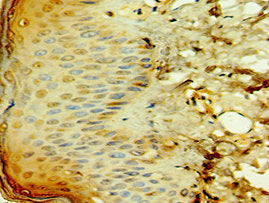 Immunohistochemistry of paraffin-embedded human skin tissue using TCTN2 Antibody at dilution of 1:100Rabbit anti-Human TCTN2 Polyclonal Antibody
