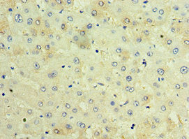 Immunohistochemistry of paraffin-embedded human liver tissue using TCTN2 Antibody at dilution of 1:100Rabbit anti-Human TCTN2 Polyclonal Antibody