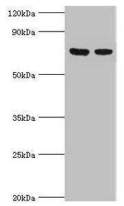 Western blot  | All lanes: TCTN2 antibody at 10μg/ml  | Lane 1: Jurkat whole cell lysate  | Lane 2: A549 whole cell lysate  | Secondary  | Goat polyclonal to rabbit IgG at 1/10000 dilution  | Predicted band size: 77 kDa  | Observed band size: 77 kDaRabbit anti-Human TCTN2 Polyclonal Antibody