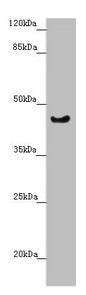 Western blot  | All lanes: RBM17 antibody at 2.35µg/ml + U251 whole cell lysate  | Secondary  | Goat polyclonal to rabbit IgG at 1/10000 dilution  | Predicted band size: 45 kDa  | Observed band size: 45 kDaRabbit anti-Human RBM17 Polyclonal Antibody