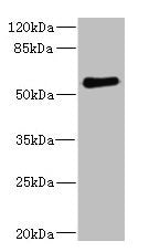 Western blot  | All lanes: FCRL2 antibody at 1.78µg/ml + 293T whole cell lysate  | Secondary  | Goat polyclonal to rabbit IgG at 1/10000 dilution  | Predicted band size: 56, 28, 21, 16, 23 kDa  | Observed band size: 56 kDa