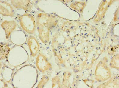 Immunohistochemistry of paraffin-embedded human kidney tissue using SFXN2 Antibody at dilution of 1:100Rabbit anti-Human SFXN2 Polyclonal Antibody