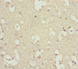 Immunohistochemistry of paraffin-embedded human brain tissue using INPP4A Antibody at dilution of 1:100