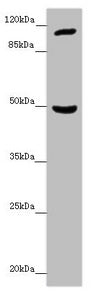 Western blot | All lanes: INPP4A antibody at 7.06 μg/ml + Mouse brain tissue | Secondary | Goat polyclonal to rabbit IgG at 1/10000 dilution | Predicted band size: 110, 106, 108 kDa | Observed band size: 110, 48 kDa