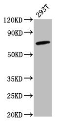 Western Blot  | Positive WB detected in: 293T whole cell lysate  | All lanes: GBP4 antibody at 2.6μg/ml  | Secondary  | Goat polyclonal to rabbit IgG at 1/50000 dilution  | Predicted band size: 74 kDa  | Observed band size: 74 kDaRabbit anti-Human GBP4 Polyclonal Antibody