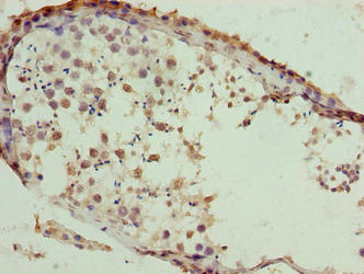 Immunohistochemistry of paraffin-embedded human testis tissue using the antibody at dilution of 1:100Rabbit anti-Human SLC26A8 Polyclonal Antibody
