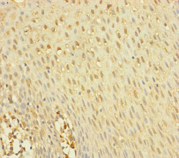 Immunohistochemistry of paraffin-embedded human tonsil tissue using YME1L1 Antibody at dilution of 1:100Rabbit anti-Human YME1L1 Polyclonal Antibody