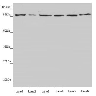 Western blot  | All lanes: YME1L1 antibody at 3.8µg/ml  | Lane 1: A549 whole cell lysate  | Lane 2: Jurkat whole cell lysate  | Lane 3: A431 whole cell lysate  | Lane 4: Hela whole cell lysate  | Lane 5: HepG2 whole cell lysate  | Lane 6: MCF-7 whole cell lysate  | Secondary  | Goat polyclonal to rabbit IgG at 1/10000 dilution  | Predicted band size: 87, 80, 76 kDa  | Observed band size: 87 kDaRabbit anti-Human YME1L1 Polyclonal Antibody