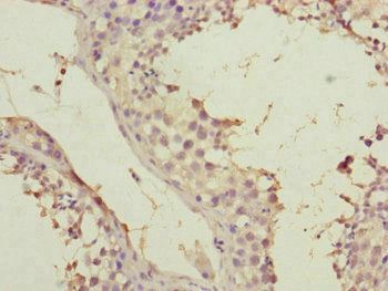 Immunohistochemistry of paraffin-embedded human testis tissue using SPICE1 Antibody at dilution of 1:100Rabbit anti-Human SPICE1 Polyclonal Antibody