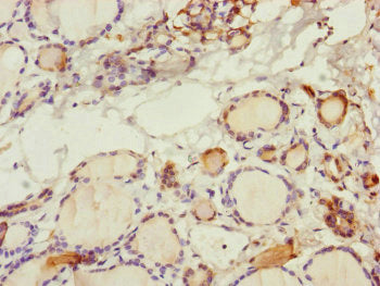 Immunohistochemistry of paraffin-embedded human thyroid tissue using SPICE1 Antibody at dilution of 1:100Rabbit anti-Human SPICE1 Polyclonal Antibody