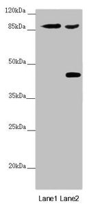 Western blot | All lanes: SPICE1 antibody at 5.43 μg/ml | Lane 1: Mouse gonadal tissue | Lane 2: 293T whole cell lysate | Secondary | Goat polyclonal to rabbit IgG at 1/10000 dilution | Predicted band size: 96 kDa | Observed band size: 96, 45 kDaRabbit anti-Human SPICE1 Polyclonal Antibody