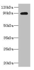 Western blot  | All lanes: OXR1 antibody at 1µg/ml + Hela whole cell lysate  | Secondary  | Goat polyclonal to rabbit IgG at 1/10000 dilution  | Predicted band size: 98, 94, 56, 28, 95, 34, 25 kDa  | Observed band size: 90 kDaRabbit anti-Human OXR1 Polyclonal Antibody