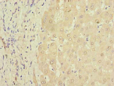 Immunohistochemistry of paraffin-embedded human liver tissue using PQLC3 Antibody at dilution of 1:100Rabbit anti-Human PQLC3 Polyclonal Antibody