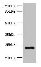 Western blot  | All lanes: PQLC3 antibody at 3µg/ml + Mouse liver tissue  | Secondary  | Goat polyclonal to rabbit IgG at 1/10000 dilution  | Predicted band size: 23, 21 kDa  | Observed band size: 23 kDaRabbit anti-Human PQLC3 Polyclonal Antibody