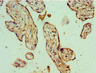 Immunohistochemistry of paraffin-embedded human placenta tissue using BANP Antibody at dilution of 1:100