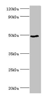 Western blot  | All lanes: BANP antibody at 6µg/ml + HepG2 whole cell lysate  | Secondary  | Goat polyclonal to rabbit IgG at 1/10000 dilution  | Predicted band size: 57, 52, 49, 54, 55, 51, 56 kDa  | Observed band size: 49 kDa