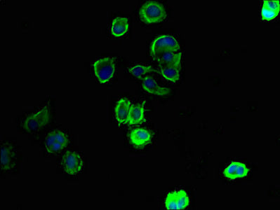 Immunofluorescent analysis of MCF-7 cells using the antibody at dilution of 1:100 and Alexa Fluor 488-congugated AffiniPure Goat Anti-Rabbit IgG(H+L)
