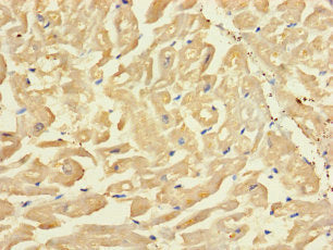 Immunohistochemistry of paraffin-embedded human heart tissue using SLC43A3 Antibody at dilution of 1:100