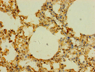 Immunohistochemistry of paraffin-embedded human lung tissue using SLC43A3 Antibody at dilution of 1:100