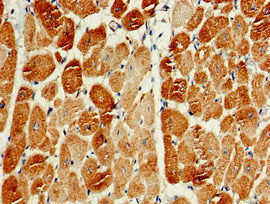 Immunohistochemistry of paraffin-embedded human heart tissue using PIK3C3 Antibody at dilution of 1:100Rabbit anti-Human PIK3C3 Polyclonal Antibody