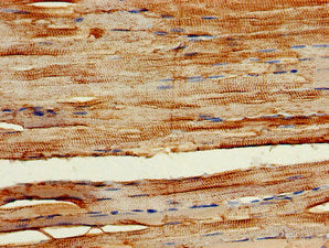 Immunohistochemistry of paraffin-embedded human skeletal muscle tissue using PIK3C3 Antibody at dilution of 1:100Rabbit anti-Human PIK3C3 Polyclonal Antibody