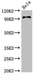Western Blot | Positive WB detected in: Hela whole cell lysate | All lanes: PIK3C3 antibody at 3.4μg/ml | Secondary | Goat polyclonal to rabbit IgG at 1/50000 dilution | Predicted band size: 102 kDa | Observed band size: 102 kDaRabbit anti-Human PIK3C3 Polyclonal Antibody