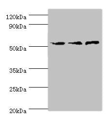 Western blot | All lanes: ACVR1C antibody at 4μg/ml | Lane 1: Mouse brain tissue | Lane 2: HepG2 whole cell lysate | Lane 3: Hela whole cell lysate | Secondary | Goat polyclonal to rabbit IgG at 1/10000 dilution | Predicted band size: 55, 38, 47, 50 kDa | Observed band size: 55 kDaRabbit anti-Human ACVR1C Polyclonal Antibody